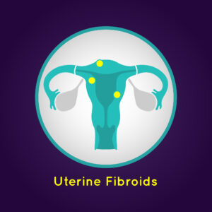 uterine fibroids Pueblo